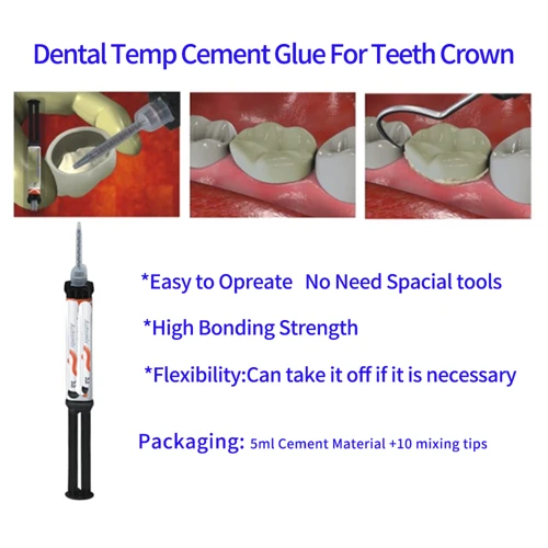 How To Apply Dental Glue