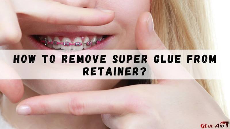 Preventing Retainer Glue Build-Up