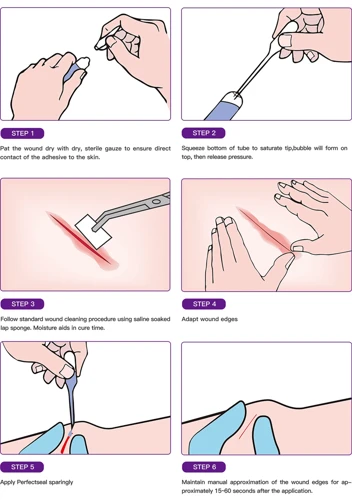 Types Of Skin Glue
