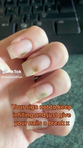 What Causes Green Nails After Nail Extensions?