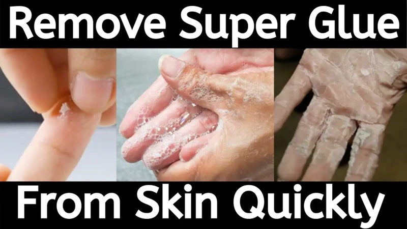 What Melts Super Glue?
