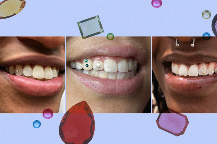 Why You Need To Be Careful When Removing Tooth Gem Glue